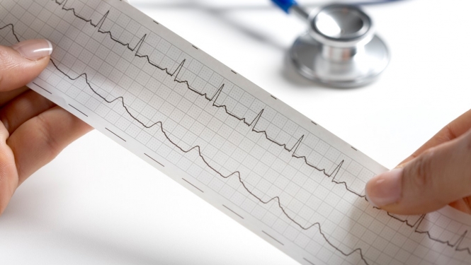 Rokās tur EKG rezultātus. Fonā stetoskops. 