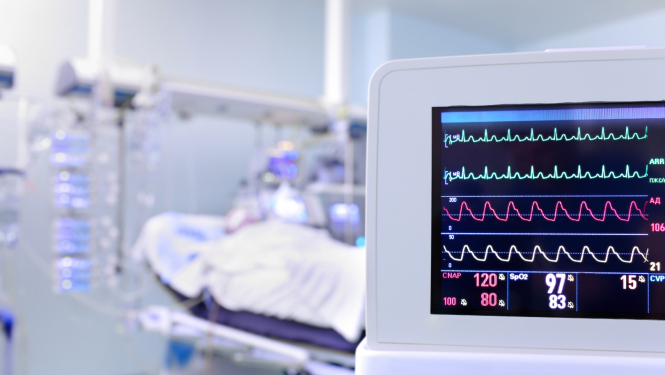ilustratīvs attēls: sirdsdarbība monitorā; avots: 123rf.com