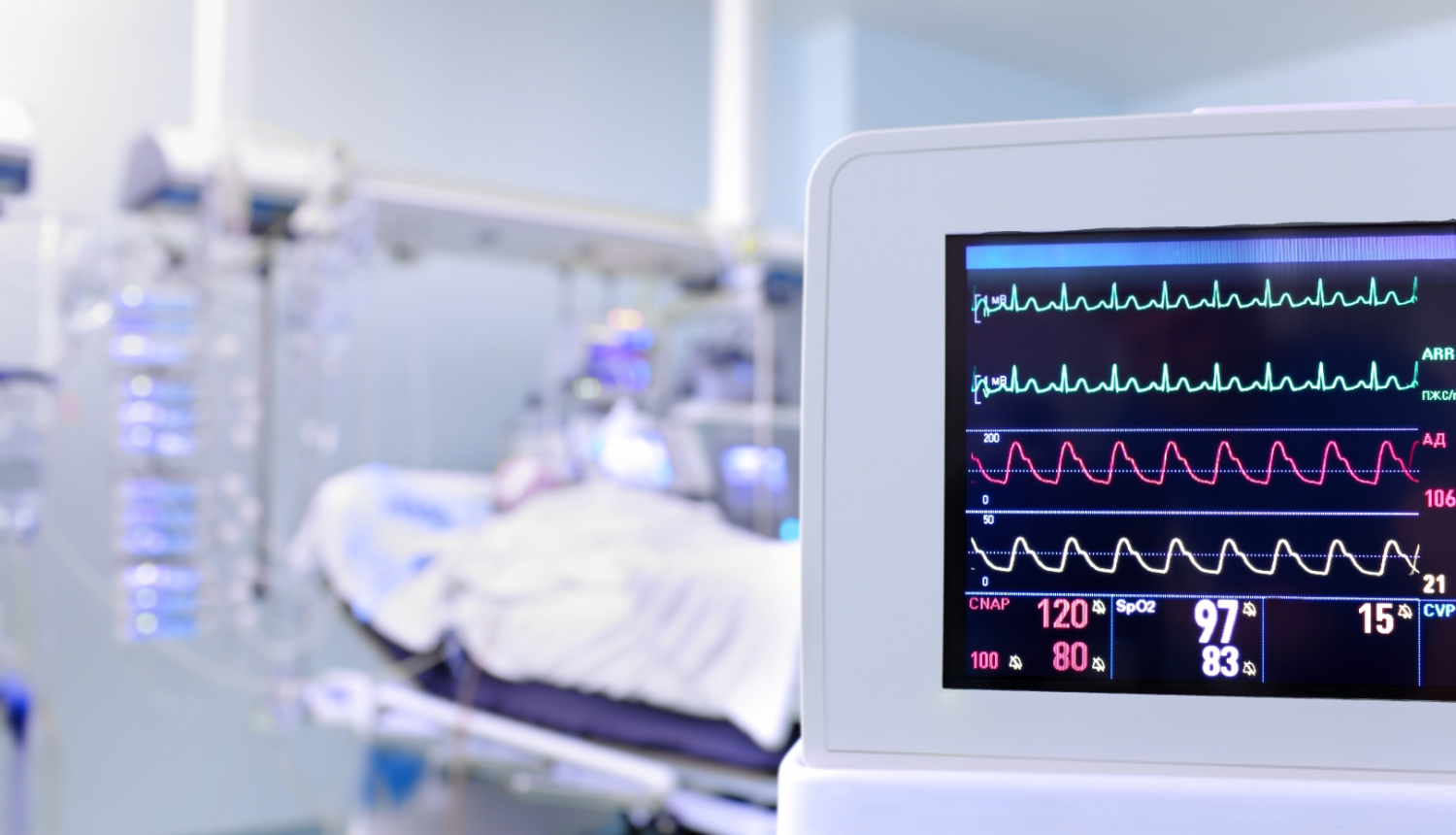 ilustratīvs attēls: sirdsdarbība monitorā; avots: 123rf.com