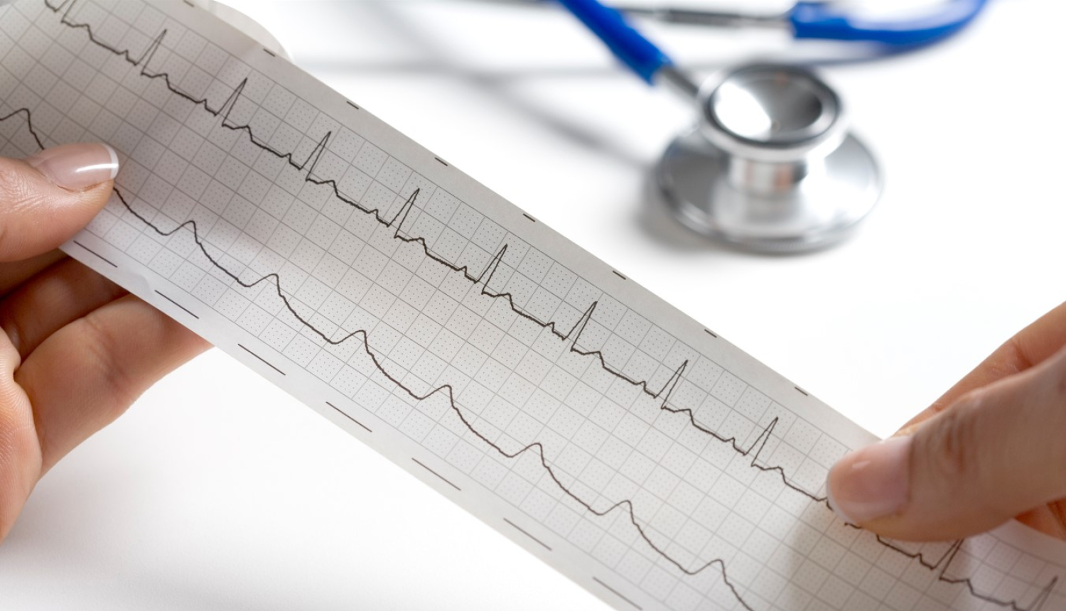 Rokās tur EKG rezultātus. Fonā stetoskops. 