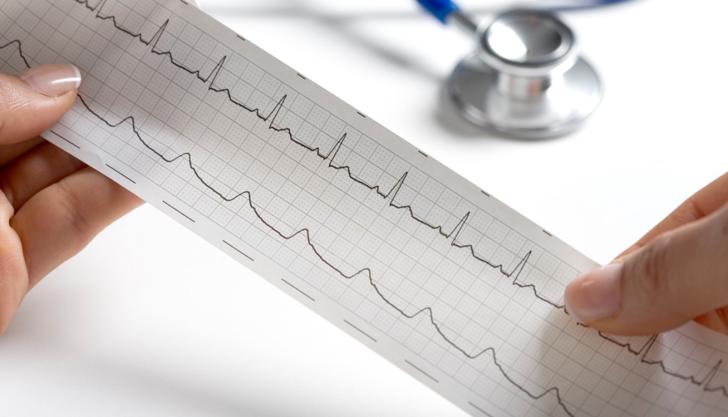 Rokās tur EKG rezultātus. Fonā stetoskops. 